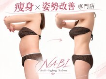 ナビ(NABI)