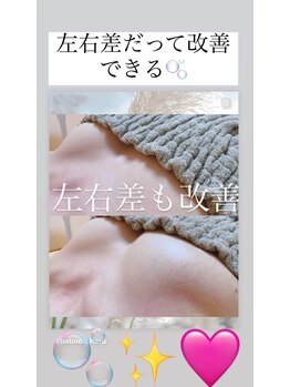 ベリンダ(belinda)/バストアップ症例