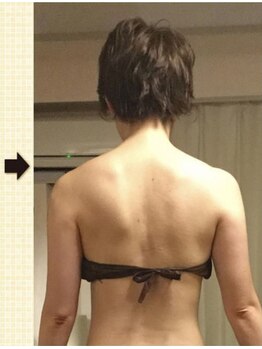 ノットノット 自由が丘(Not Knot)/２.ブライダル 上半身集中１回後
