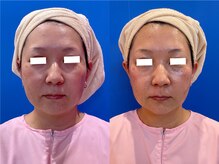 ソイズ 上中居店(SOIS)/小顔コルギ