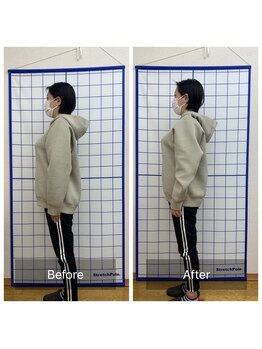 池川整骨院/姿勢矯正ビフォーアフター