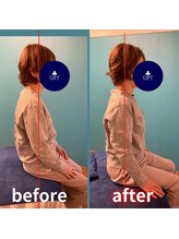 ギフトリラクゼーション 久留米(GIFTリラクゼーション)/☆before after☆