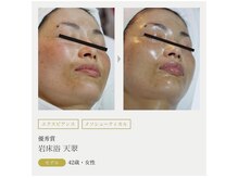 まりも化粧品店/ホワイトスノーピール