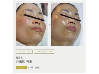 まりも化粧品店/ホワイトスノーピール