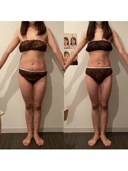 イロドリ 南浦和(irodori)/産後骨盤矯正Before＆After