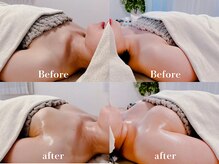 ローズルート(Rose route)/←30代後半 →20代前半 バスト