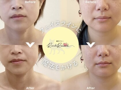 ロンルナール(Rond Renard)の写真