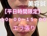 【平日10時～15時限定】エラで顔の大きさが気になる方に◎（美容鍼＋EMS機械)