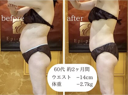 エピファニー(Epi phany Total Beauty Salon)の写真