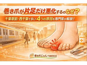 巻き爪じゅん 船橋店/巻き爪片足だけ悪化するのなぜ？