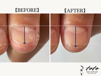 トトヘアー アンド ネイル(toto hair and nail)/【toto式】深爪育成ネイルケア