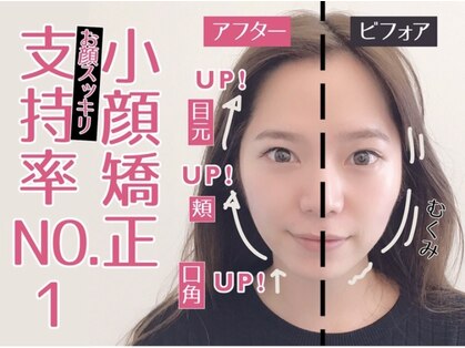 小顔ラボ 心斎橋店(小顔LABO)の写真