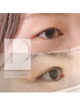 ニコ(nico)/ダブルアイリフト