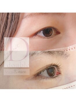 ニコ(nico)/ダブルアイリフト