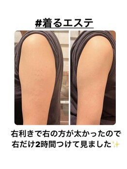 エムプリュ 心斎橋店(M.plus)/着るエステ