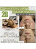 【2Bハーブピーリング3g】メンズ毛穴洗浄+ヒト幹細胞導入で肌荒れ/ニキビケア