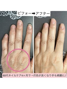 桃の木 吉祥寺店/きれいな手は日々のケアが大切