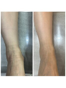 ドクターネイル爪革命 十条店/むくみにフットリフレ