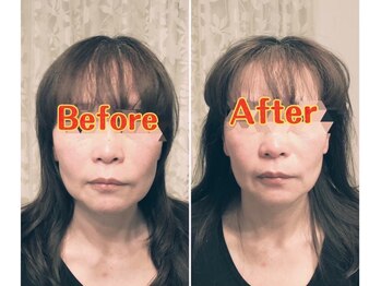 フェイス 本店 盛岡岩手(FACE)/