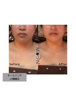 ブルームーン(BLUE MOON)/小顔矯正オールハンドエステ