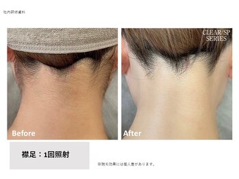 アマナ(AMANA)/スッキリ清潔感♪