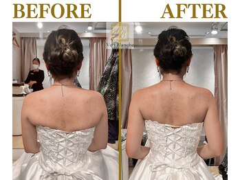 ヴェールブランシュ 町田(Vert Blanche)/#ブライダルエステ#痩身#背中