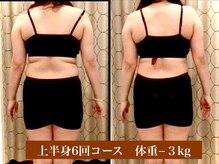 サロン セドナ(SALON SEDONA)/上半身リンパ痩身 6回コース