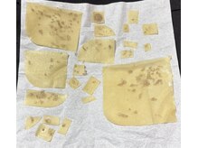 アイラッシュ ラボ ヒトミ(Eyelash Lab Hitomi)/1週間でシミがペロン♪