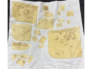 アイラッシュ ラボ ヒトミ(Eyelash Lab Hitomi)/1週間でシミがペロン♪