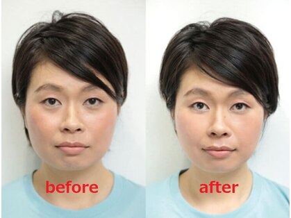 エーパシ カイロプラクティックの写真