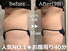 ルナステラ 七尾店の雰囲気（食事制限・辛い運動なしでこの結果。（痩身/ダイエット））