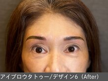 オアシスラグーン(OASIS LAGOON)/アイブロウデザイン6（after）