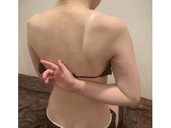 シェノン(CHAINON)/肩甲骨はがしと巻き肩改善！