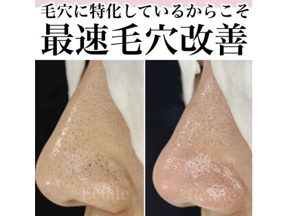 エクラーレ(Eclale)の写真