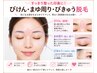 顔+眉間眉弓・眉周り~ 細かいところもスッキリ♪(パック付)4800円