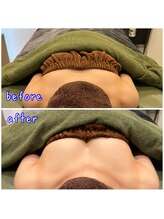 ビープラス(B+)/before＆after