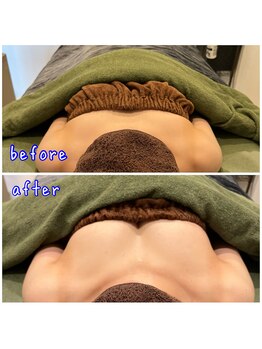 ビープラス(B+)/before＆after