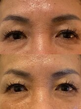 ビーアイリー(Be irie)/フェイシャルエステ直後の変化