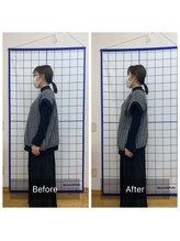 池川整骨院/姿勢矯正ビフォーアフター