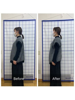 池川整骨院/姿勢矯正ビフォーアフター