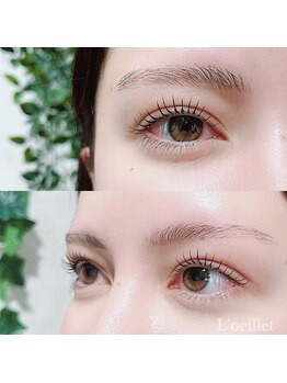 ルイエ(L’oeillet)/