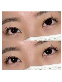 シュピネ(Choupinet)/エクパーマ120本