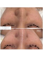 クレア(Clair)/イラストリアス症例