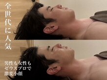 ラースパアザブ 札幌円山(La SPA azabu)/La SPA麻布-札幌円山-小顔施術