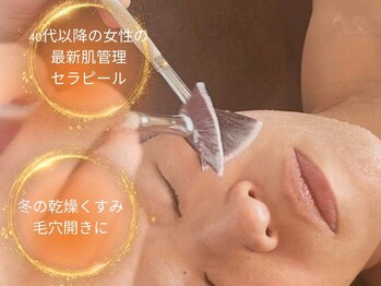 シェノン(Chainon)