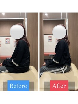 ナオル整体 宮崎院(NAORU整体)/20代女性施術事例【猫背改善】