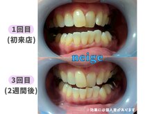 ネージュ(neige)/50代後半/女性/ コーヒー1日5杯