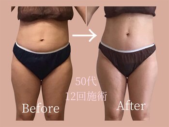 モア 多治見店(MORE)/お客様 ビフォーアフター