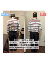 整体サロン　アンティオール　大森本店【頭痛/不眠/耳鳴り/腰痛/肩こり/骨盤矯正】/Before→After【姿勢改善】
