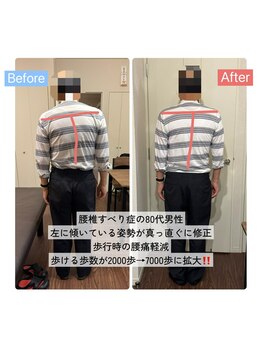 整体サロン　アンティオール　大森本店【頭痛/不眠/耳鳴り/腰痛/肩こり/骨盤矯正】/Before→After【姿勢改善】